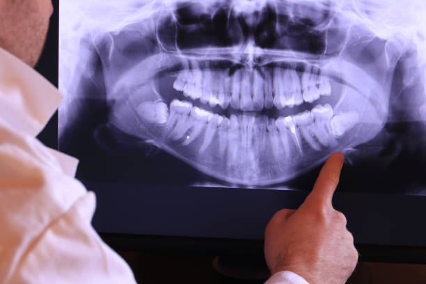 Best Emergency Denture Repair in Covington, WA