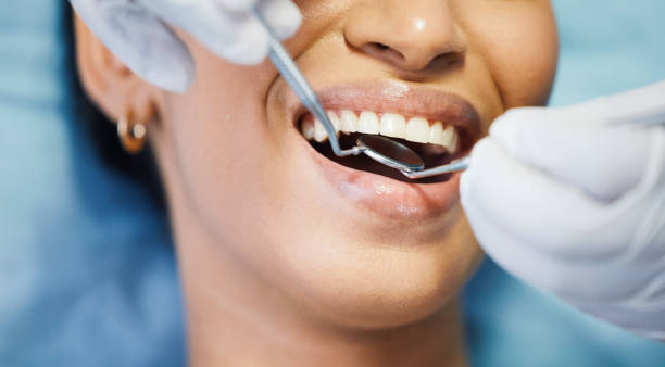 Best Emergency Dental Care for Broken or Chipped Teeth in Covington, WA