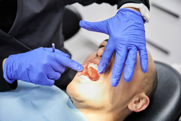 Best Emergency Gum Treatment in Covington, WA