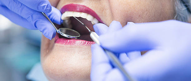 Best Emergency Root Canal Treatment in Covington, WA